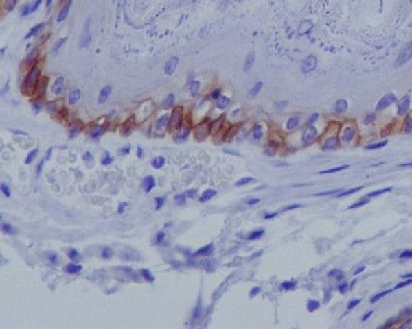 Anti-Collagen XVII alpha 1 Rabbit Monoclonal Antibody