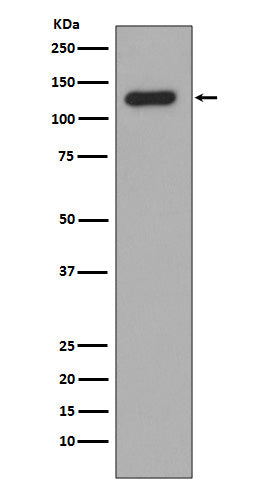 Anti-Collagen XVII alpha 1 Rabbit Monoclonal Antibody