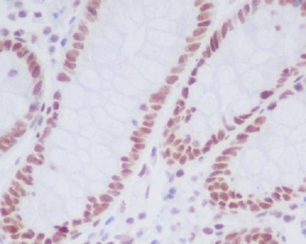 Anti-KDM1A Rabbit Monoclonal Antibody
