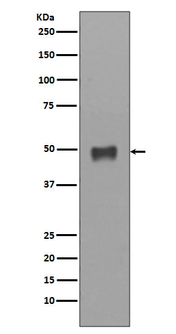 Anti-Cytokeratin 17 Rabbit Monoclonal Antibody