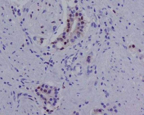 Anti-Androgen Receptor Rabbit Monoclonal Antibody