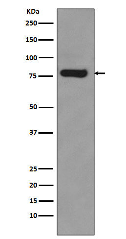 Anti-Androgen Receptor Rabbit Monoclonal Antibody