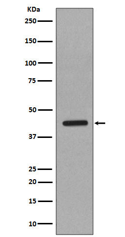 Anti-Caspase 1 Rabbit Monoclonal Antibody