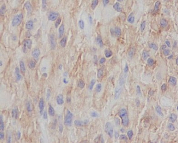 Anti-NGFR Rabbit Monoclonal Antibody
