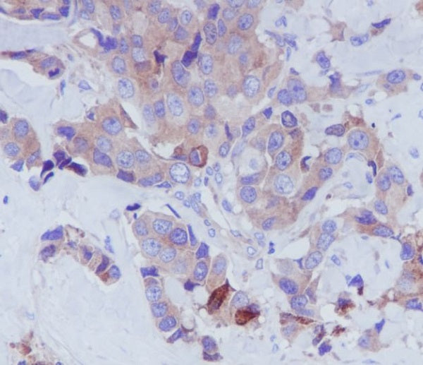 Anti-Transferrin Rabbit Monoclonal Antibody
