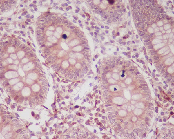 Anti-p16 ARC Rabbit Monoclonal Antibody