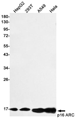 Anti-p16 ARC Rabbit Monoclonal Antibody