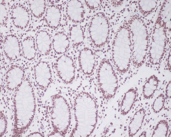 Anti-PAX2 Rabbit Monoclonal Antibody