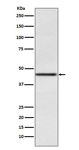 Anti-PAX2 Rabbit Monoclonal Antibody