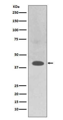 Anti-TRAM2 Rabbit Monoclonal Antibody