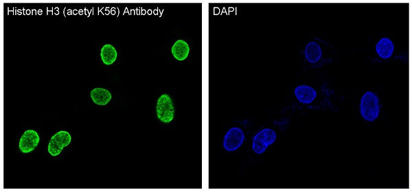 Anti-Acetyl-Histone H3 (Lys56) Rabbit Monoclonal Antibody