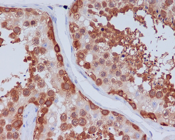 Anti-Hsp90 beta Rabbit Monoclonal Antibody