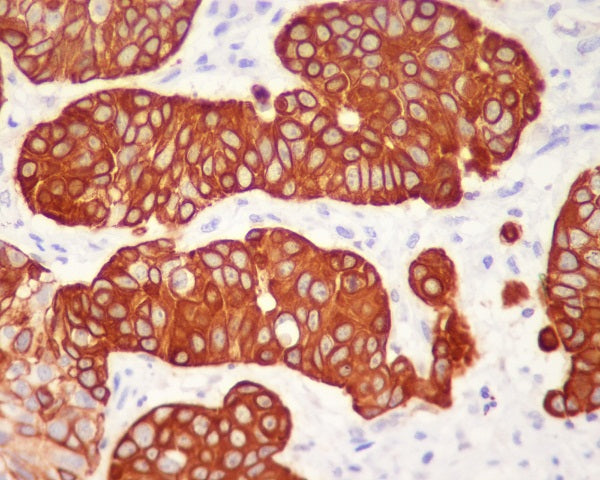 Anti-Cytokeratin 5 Rabbit Monoclonal Antibody