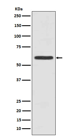 Anti-Cytokeratin 5 Rabbit Monoclonal Antibody
