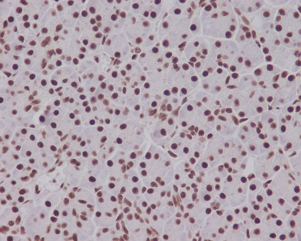 Anti-Phospho-Smad5 (Ser463/465) Rabbit Monoclonal Antibody