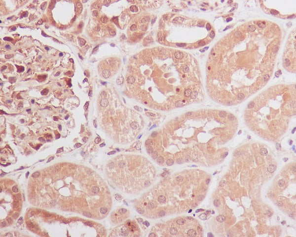 Anti-ID1 Rabbit Monoclonal Antibody