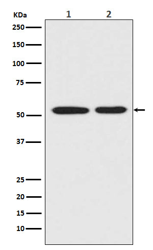 Anti-p53 Rabbit Monoclonal Antibody