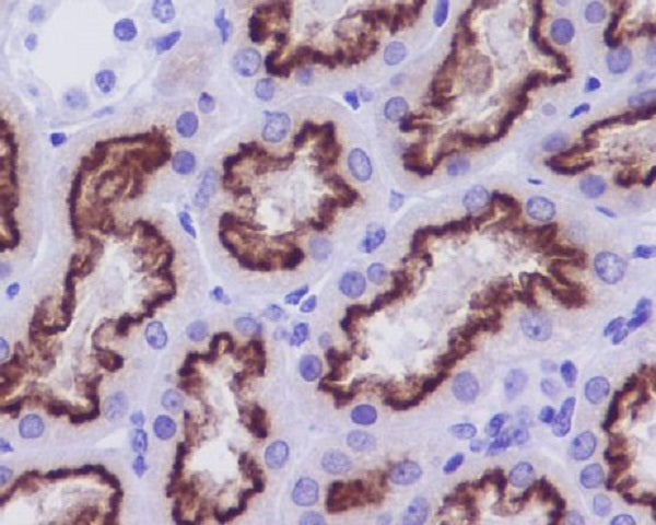 Anti-Cubilin Rabbit Monoclonal Antibody