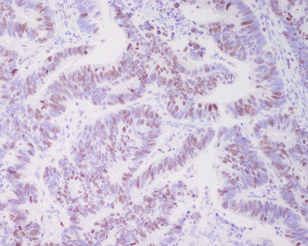 Anti-Topoisomerase II alpha Rabbit Monoclonal Antibody