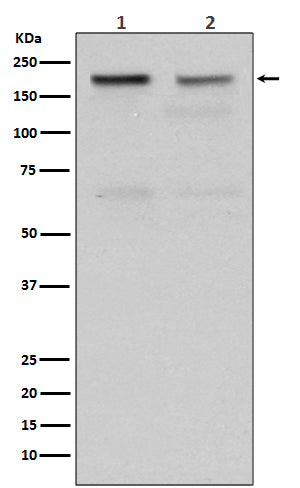 Anti-Topoisomerase II alpha Rabbit Monoclonal Antibody