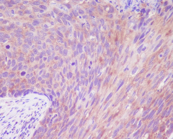 Anti-Desmoglein 1 Rabbit Monoclonal Antibody