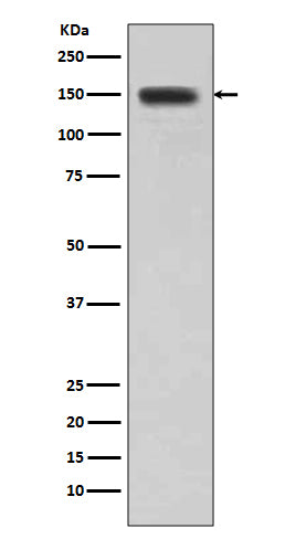 Anti-Desmoglein 1 Rabbit Monoclonal Antibody