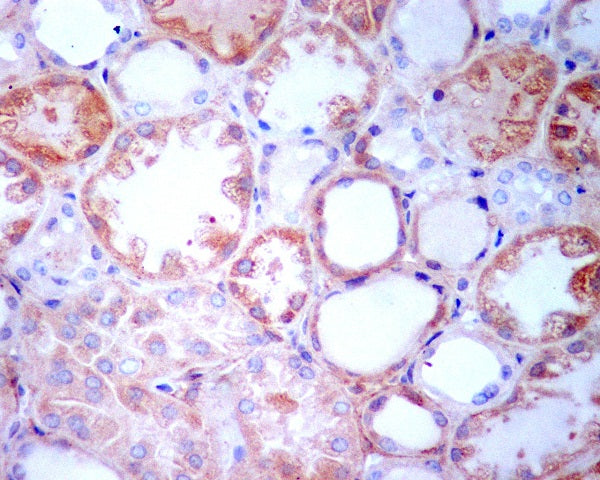 Anti-TGFBI Rabbit Monoclonal Antibody
