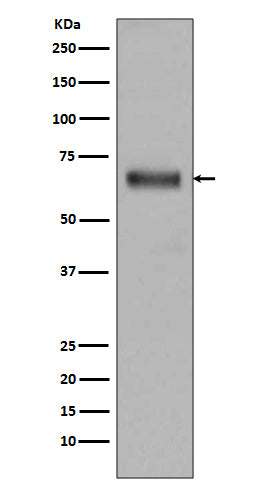 Anti-TGFBI Rabbit Monoclonal Antibody