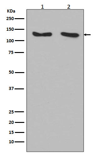 Anti-RNF20 Rabbit Monoclonal Antibody