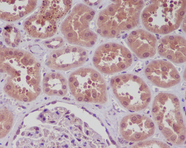 Anti-NF-KB p105 Rabbit Monoclonal Antibody