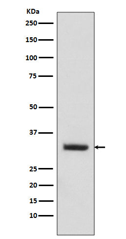 Anti-C10orf63 Rabbit Monoclonal Antibody