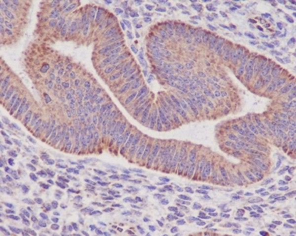 Anti-Sonic Hedgehog Rabbit Monoclonal Antibody