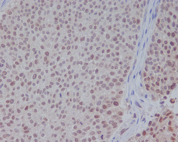 Anti-ERK1 Rabbit Monoclonal Antibody
