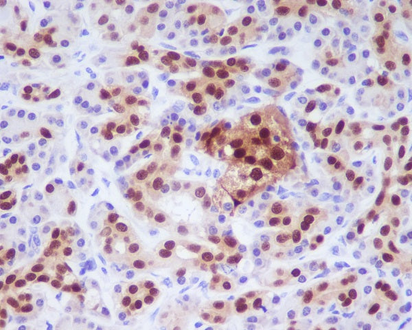 Anti-PDX1 Rabbit Monoclonal Antibody