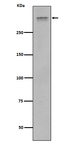 Anti-Plectin Rabbit Monoclonal Antibody