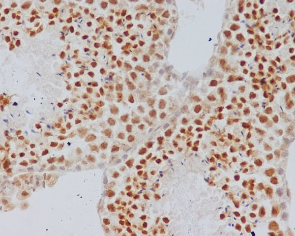 Anti-alpha Synuclein Rabbit Monoclonal Antibody