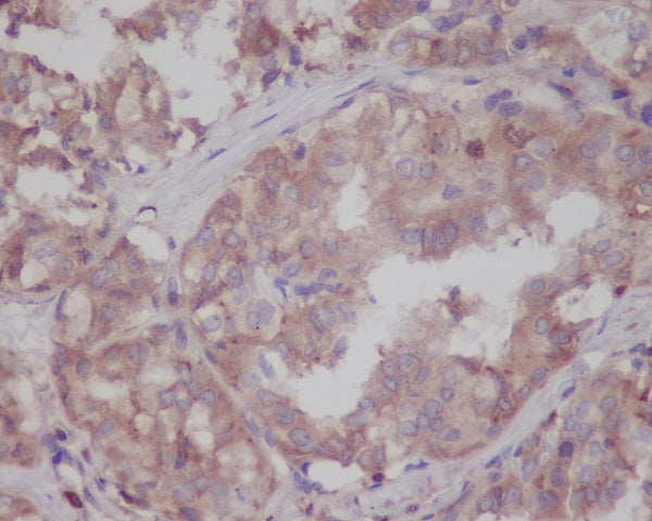 Anti-LRRK2 Rabbit Monoclonal Antibody