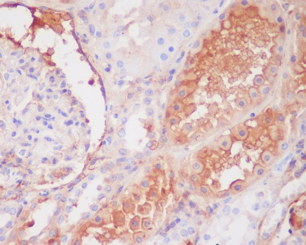 Anti-Complement C9 Rabbit Monoclonal Antibody