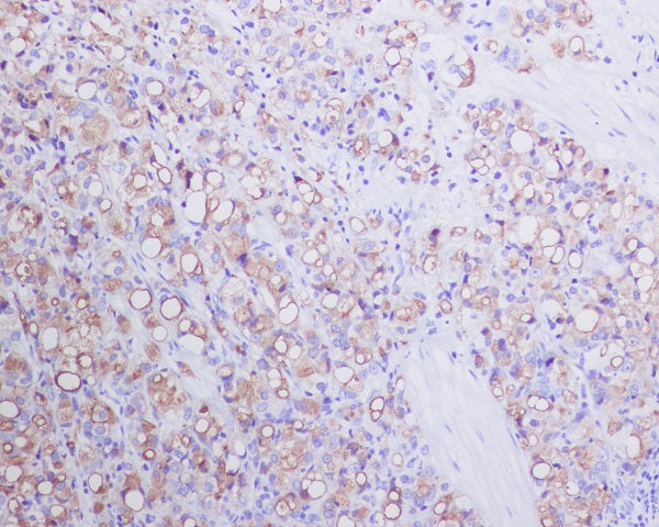 Anti-PSMA Rabbit Monoclonal Antibody