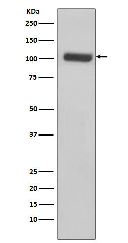 Anti-PSMA Rabbit Monoclonal Antibody