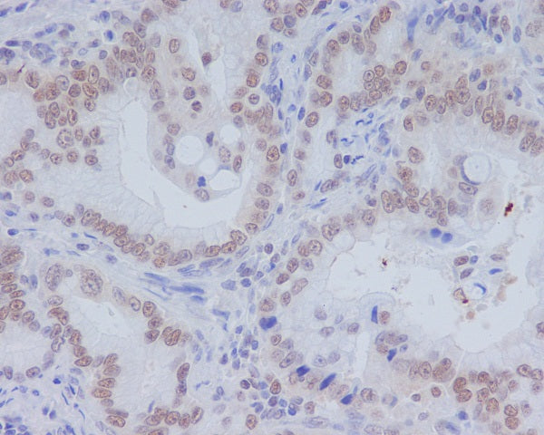 Anti-CD11b Rabbit Monoclonal Antibody