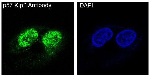 Anti-p57 Kip2 Rabbit Monoclonal Antibody