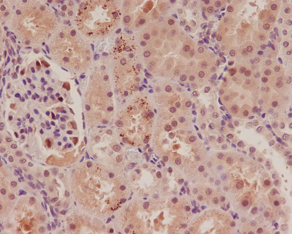 Anti-p57 Kip2 Rabbit Monoclonal Antibody