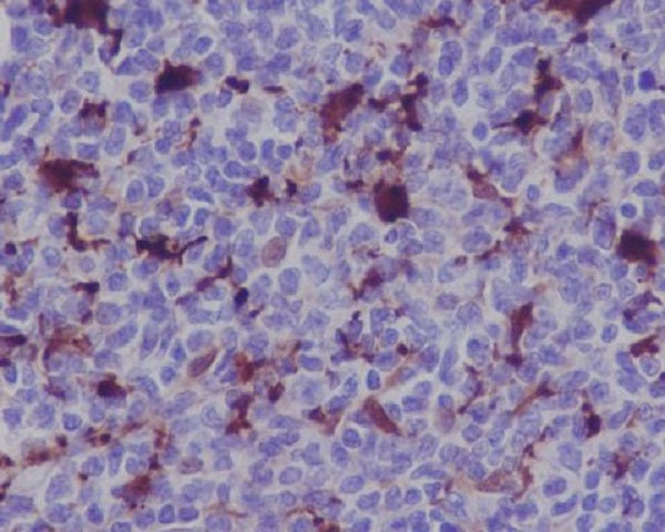 Anti-MERTK Rabbit Monoclonal Antibody