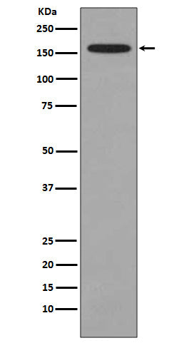 Anti-KMT4 Rabbit Monoclonal Antibody