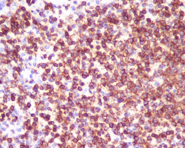 Anti-CD45 Rabbit Monoclonal Antibody