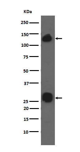 Anti-Integrin alpha V Rabbit Monoclonal Antibody