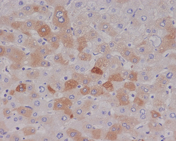 Anti-C Reactive Protein Rabbit Monoclonal Antibody