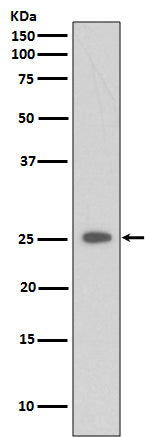 Anti-C Reactive Protein Rabbit Monoclonal Antibody