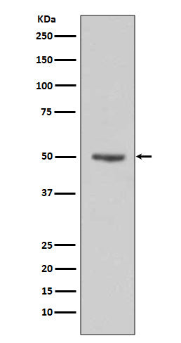 Anti-Cyclin E1 Rabbit Monoclonal Antibody